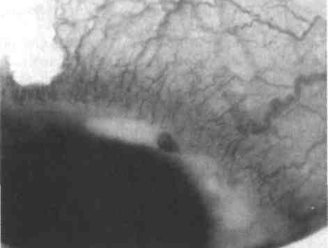 Клинические лекции по офтальмологии - image06.png