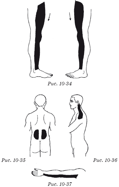 Терапевтические упражнения китайской медицины - i_062.png