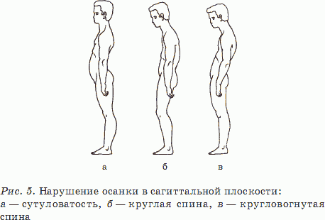 Здоровый позвоночник – красивая осанка, прекрасное здоровье - _05.png