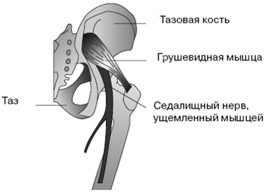 Все о здоровье ваших ног. От младенчества до старости - pic_17.png