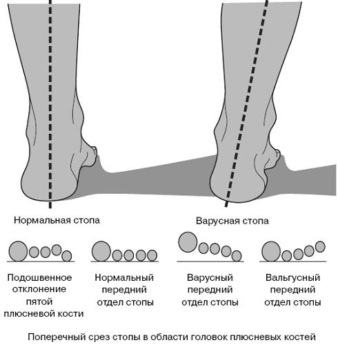 Все о здоровье ваших ног. От младенчества до старости - pic_6.png