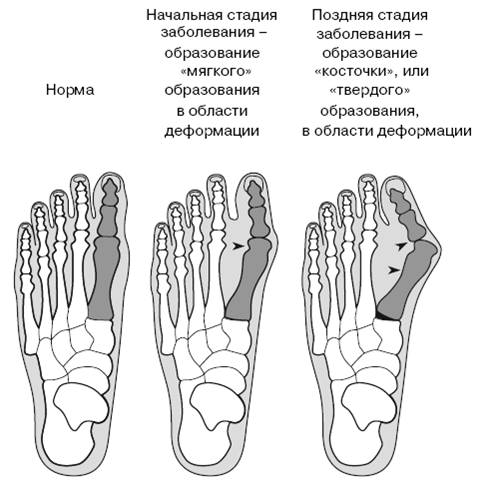 Все о здоровье ваших ног. От младенчества до старости - pic_7.png