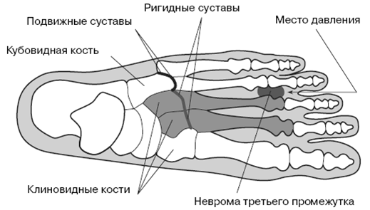 Все о здоровье ваших ног. От младенчества до старости - pic_8.png