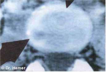 Новая Немецкая Медицина. Пять биологических законов - i_008.jpg