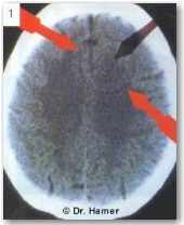Новая Немецкая Медицина. Пять биологических законов - i_012.jpg