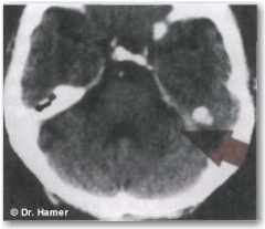Новая Немецкая Медицина. Пять биологических законов - i_014.jpg