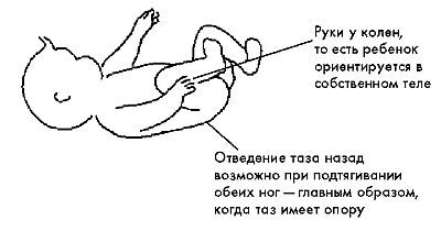 Ребенок с церебральным параличом. Помощь, уход, развитие. Книга для родителей - i_023.jpg