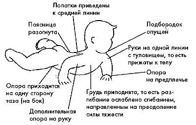 Ребенок с церебральным параличом. Помощь, уход, развитие. Книга для родителей - i_025.jpg