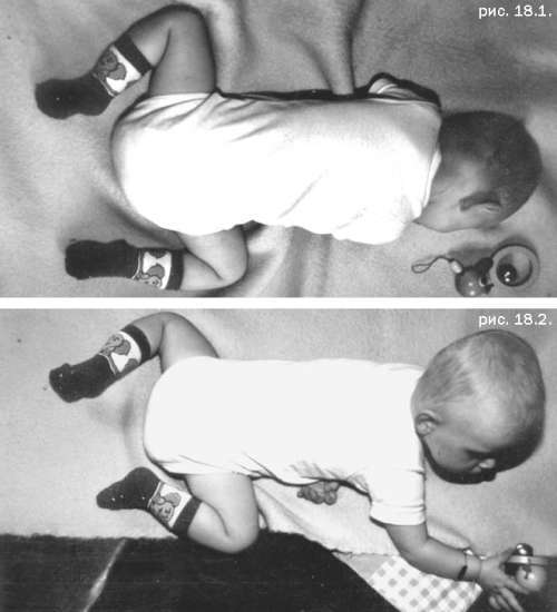 Помощь детям с церебральным параличом - r027.jpg