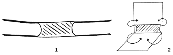 Помощь детям с церебральным параличом - _114_2.png