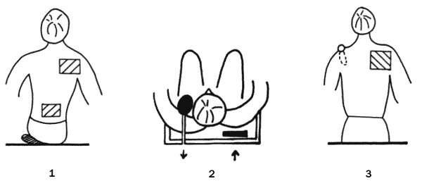 Помощь детям с церебральным параличом - _245.png