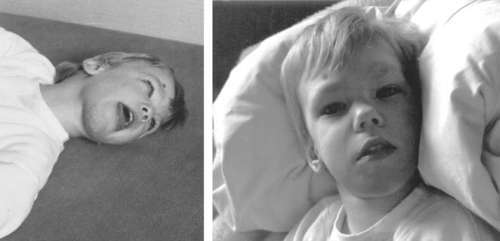 Помощь детям с церебральным параличом - r033.jpg