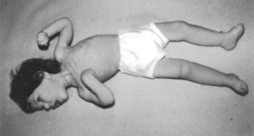 Помощь детям с церебральным параличом - r052.jpg