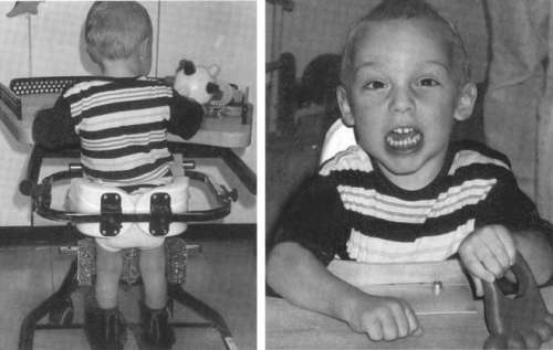 Помощь детям с церебральным параличом - r067.jpg