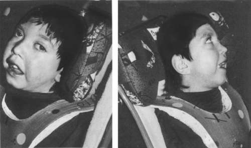 Помощь детям с церебральным параличом - r072.jpg