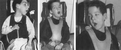 Помощь детям с церебральным параличом - r073.jpg