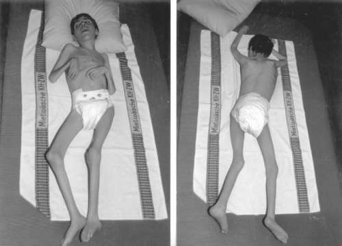 Помощь детям с церебральным параличом - r086.jpg