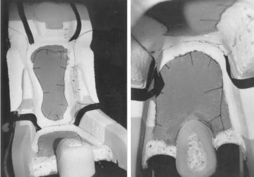 Помощь детям с церебральным параличом - r088.jpg