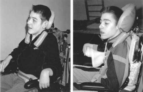 Помощь детям с церебральным параличом - r100.jpg