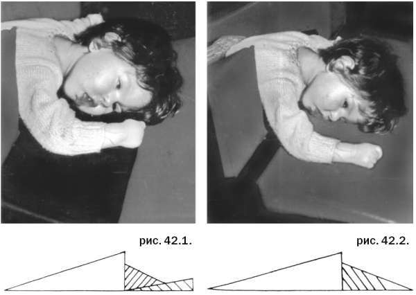Помощь детям с церебральным параличом - r148.jpg