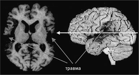 Мозг и душа. Как нервная деятельность формирует наш внутренний мир - i_003.png