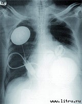 Журнал «Компьютерра» № 12 от 27 марта 2007 года - _r680_3_1.jpg