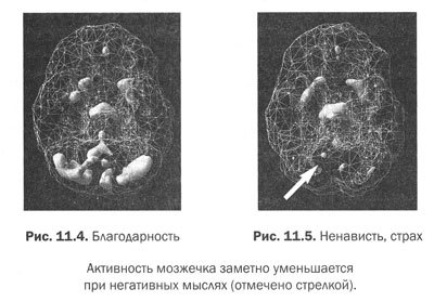 Измени мозг - изменится и тело - _45.jpg