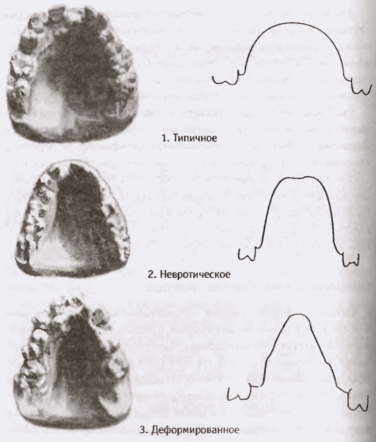 ШИЗОФРЕНИЯ: краткое введение - i_015.png