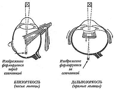 Улучшите ваше зрение - _02.jpg