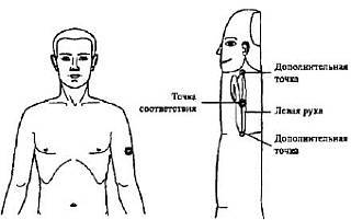 Пальцетерапия - _38.jpg