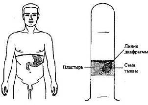 Пальцетерапия - _45.jpg