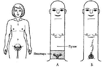 Пальцетерапия - _93.jpg