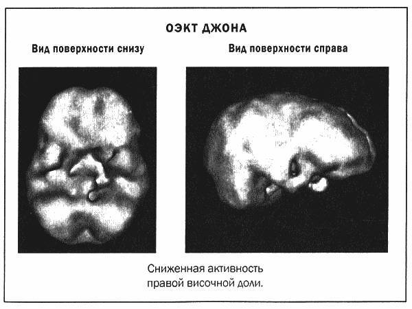 Мозг и душа - _18.jpg