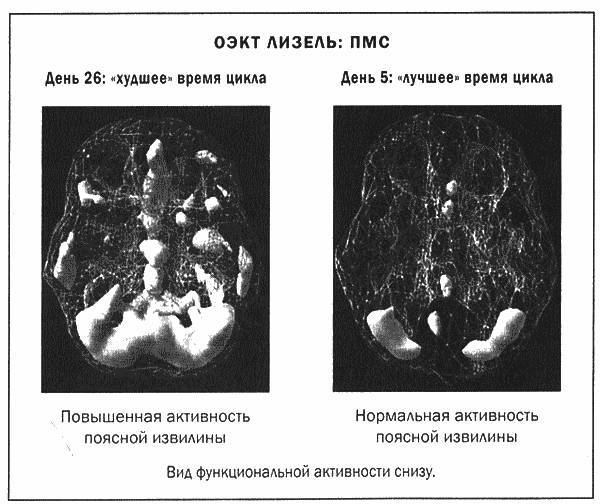 Мозг и душа - _36.jpg