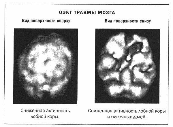 Мозг и душа - _19.jpg