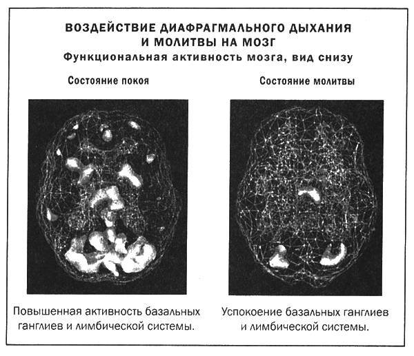 Мозг и душа - _41.jpg