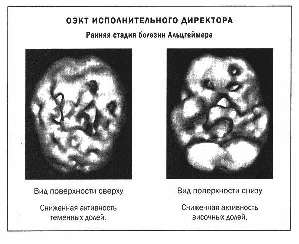 Мозг и душа - _25.jpg