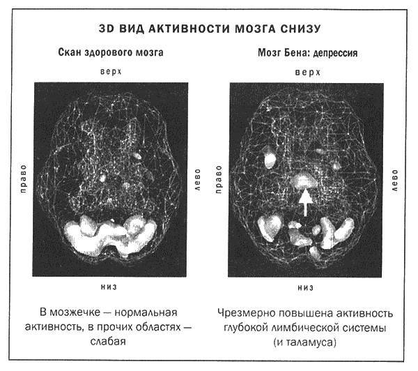 Мозг и душа - _4.jpg