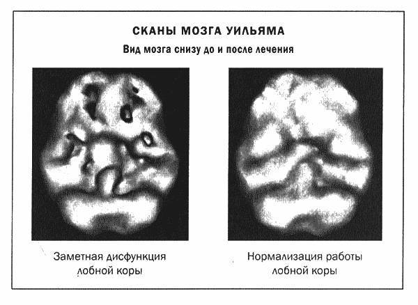 Мозг и душа - _8.jpg