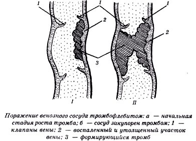 Секреты гирудотерапии - i_042.jpg