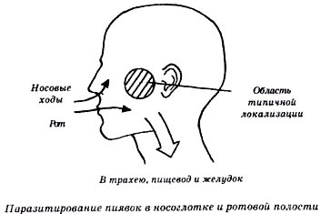 Секреты гирудотерапии - i_060.jpg