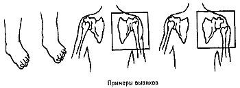 Стиль спецназа. Система боевого выживания - _41.jpg