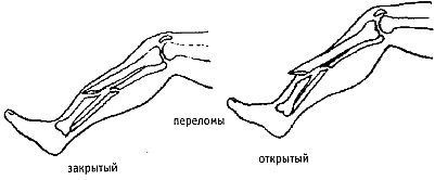 Стиль спецназа. Система боевого выживания - _42.jpg