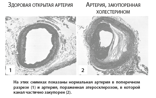 Здоровое сердце. Уникальная программа оздоровления сердечно-сосудистой системы - i_004.png