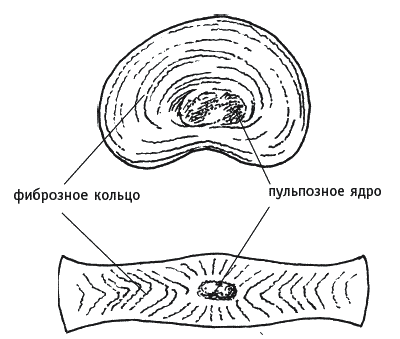 Как избавиться от боли в спине - _015.png