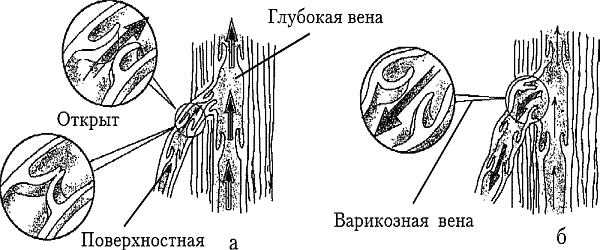 Варикозное расширение вен. Лечение традиционными и нетрадиционными методами - _02.png