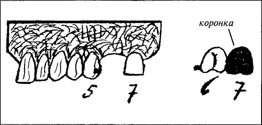 Агония и смерть Адольфа Гитлера - _30.jpg