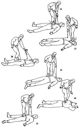 Как победить «зеленого берета» - _31.jpg_0