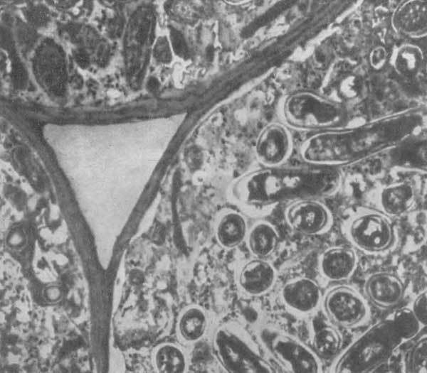 Путешествие в страну микробов - n_34.jpg