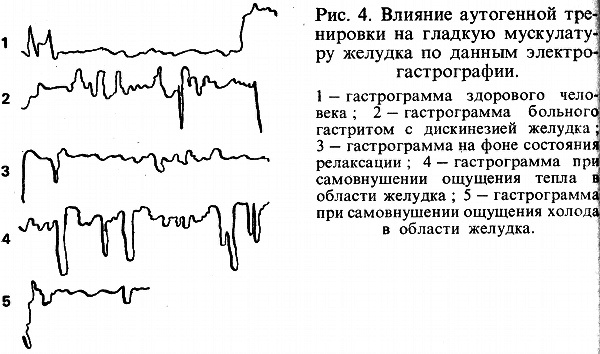 Аутогенная тренировка - img_7.png